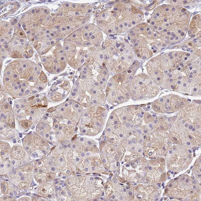 AGXT2L1 Antibody - BSA Free Immunohistochemistry: AGXT2L1 Antibody - BSA Free [NBP1-91655]