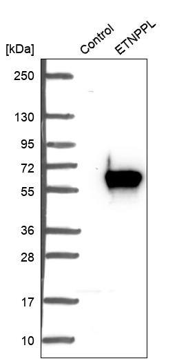 AGXT2L1 Antibody - BSA Free Western Blot: AGXT2L1 Antibody - BSA Free [NBP1-91655]