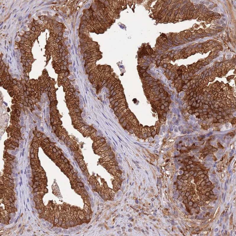 ALDH1A3 Antibody - BSA Free Immunohistochemistry: ALDH1A3 Antibody - BSA Free [NBP1-91657]