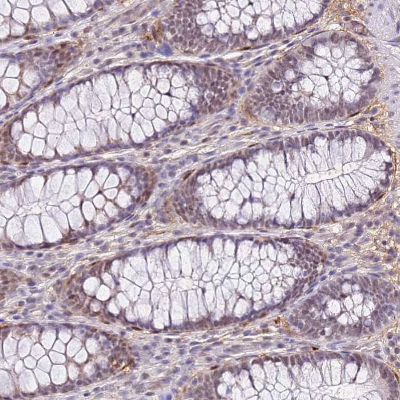 ALDH1A3 Antibody - BSA Free Immunohistochemistry: ALDH1A3 Antibody - BSA Free [NBP1-91657]