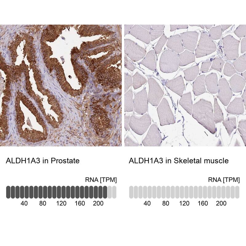 ALDH1A3 Antibody - BSA Free Immunohistochemistry: ALDH1A3 Antibody - BSA Free [NBP1-91657]