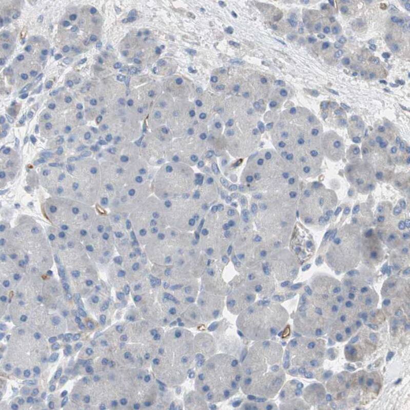 Alkaline Phosphatase, Tissue Non-Specific Antibody - BSA Free Immunohistochemistry: Alkaline Phosphatase, Tissue Non-Specific Antibody - BSA Free [NBP1-91660]