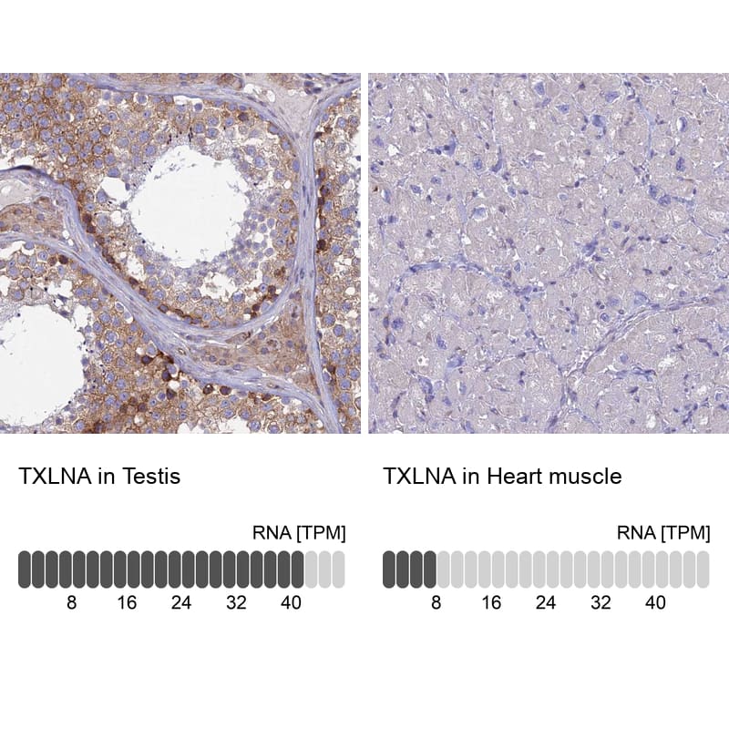 alpha-Taxilin Antibody - BSA Free Immunohistochemistry: alpha-Taxilin Antibody - BSA Free [NBP1-91662]
