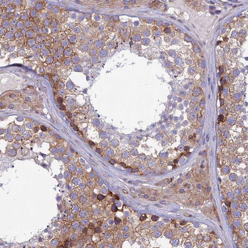 alpha-Taxilin Antibody - BSA Free Immunohistochemistry: alpha-Taxilin Antibody - BSA Free [NBP1-91662]