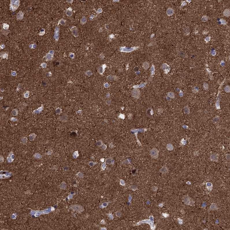 AMN1 Antibody - BSA Free Immunohistochemistry: AMN1 Antibody - BSA Free [NBP1-91663]