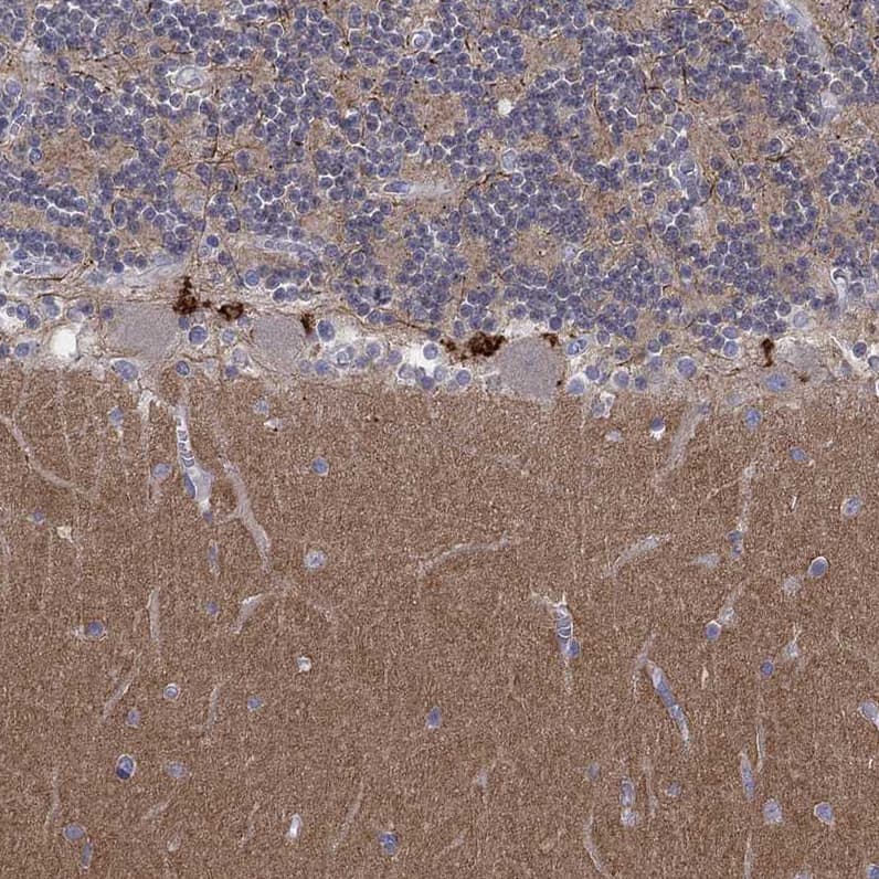 AMN1 Antibody - BSA Free Immunohistochemistry: AMN1 Antibody - BSA Free [NBP1-91663]