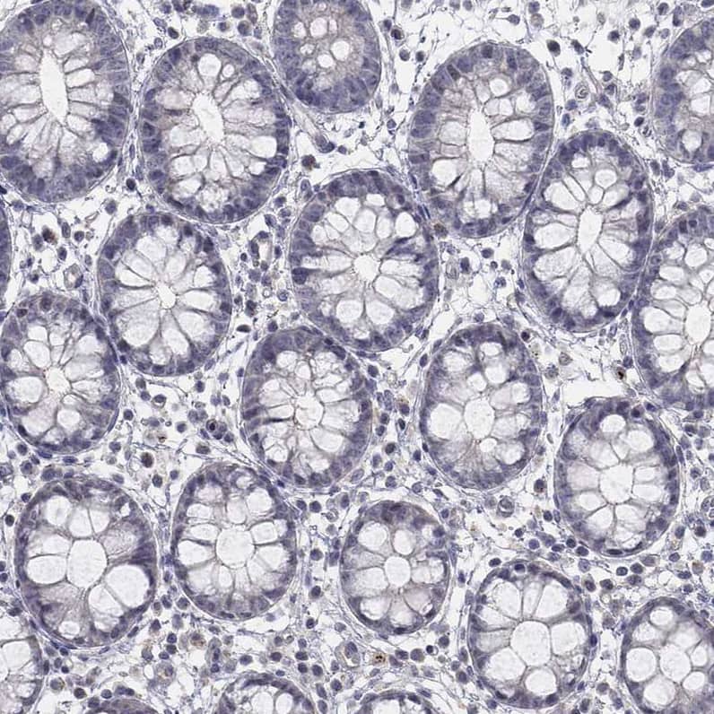 AMN1 Antibody - BSA Free Immunohistochemistry: AMN1 Antibody - BSA Free [NBP1-91663]