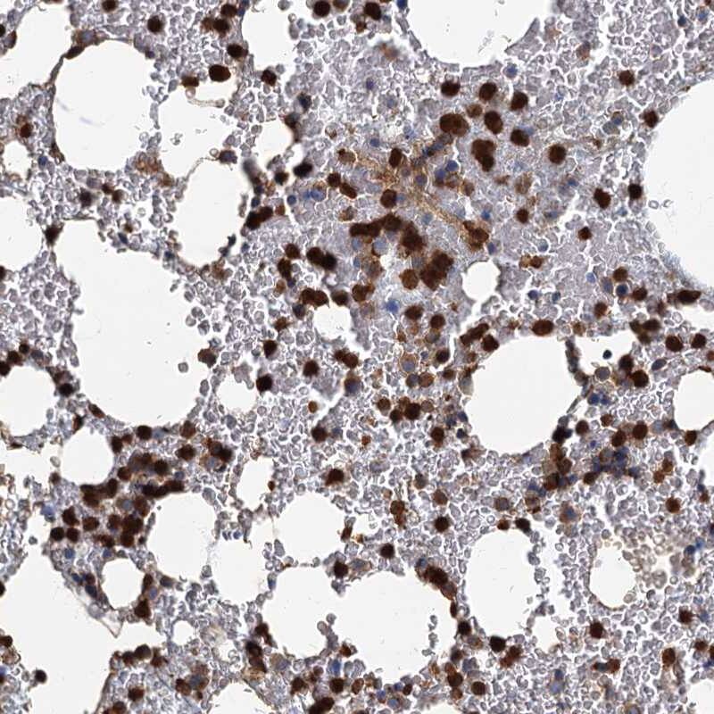 ANKDD1A Antibody - BSA Free Immunohistochemistry-Paraffin: ANKDD1A Antibody [NBP1-91667]