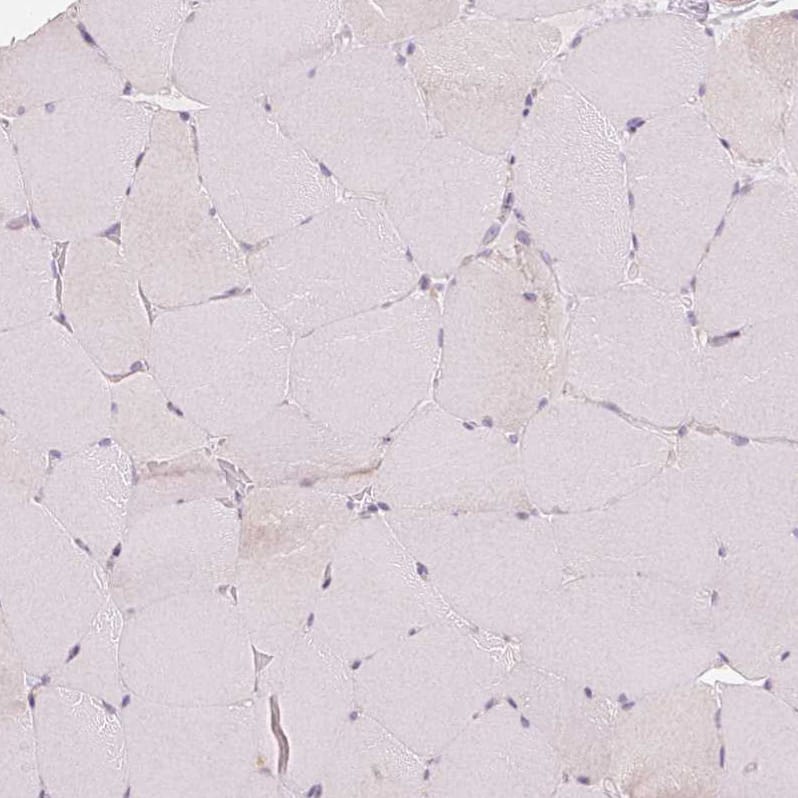 Aquaporin-8 Antibody - BSA Free Immunohistochemistry: Aquaporin-8 Antibody - BSA Free [NBP1-91676]