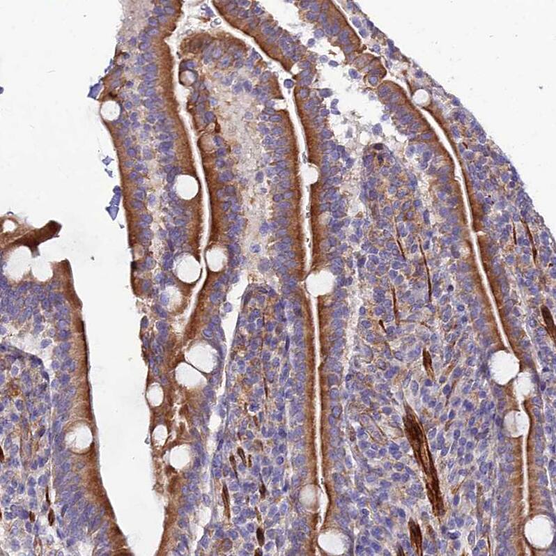 ARMER Antibody - BSA Free Immunohistochemistry: ARMER Antibody - BSA Free [NBP1-91681]