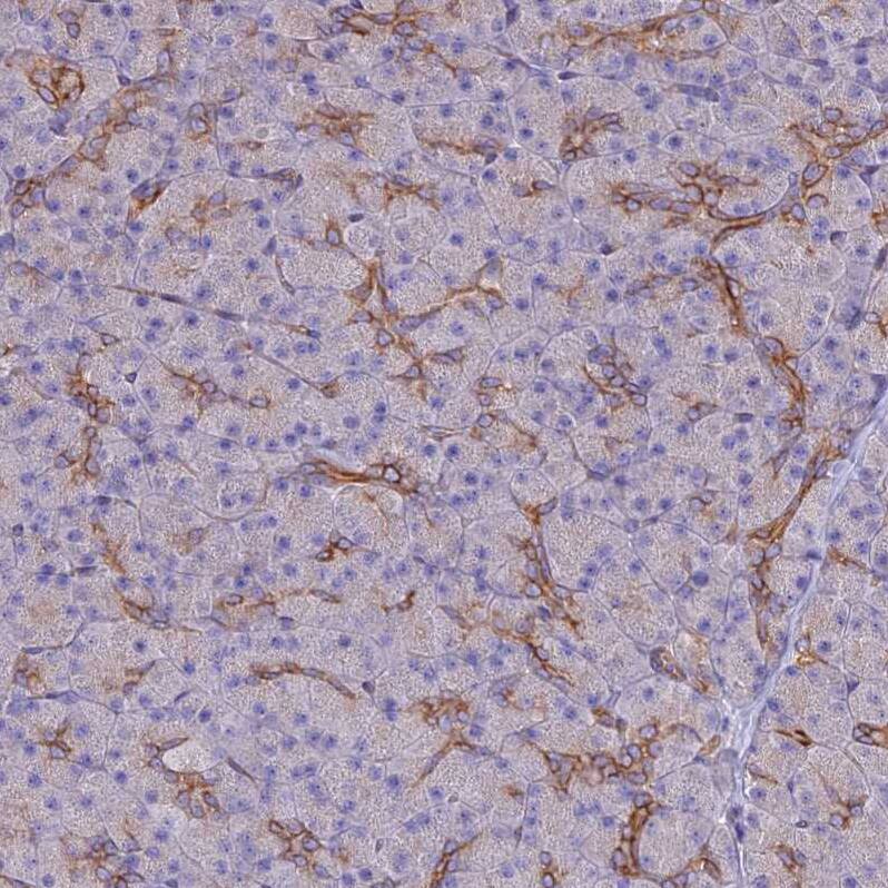 ARMER Antibody - BSA Free Immunohistochemistry: ARMER Antibody - BSA Free [NBP1-91681]