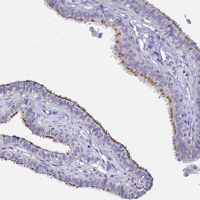 ARP10 Antibody - BSA Free Immunohistochemistry: ARP10 Antibody - BSA Free [NBP1-91682]