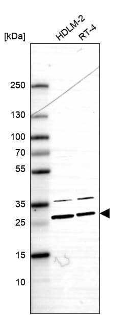 ARP10 Antibody - BSA Free Western Blot: ARP10 Antibody - BSA Free [NBP1-91682]