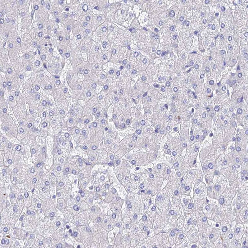 ARP10 Antibody - BSA Free Immunohistochemistry: ARP10 Antibody - BSA Free [NBP1-91682]