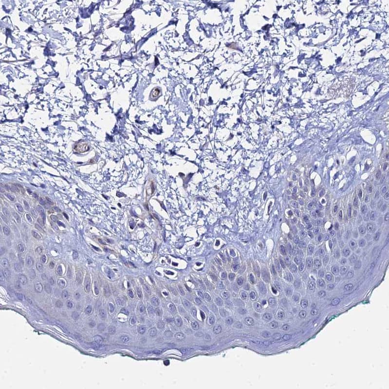 ARP10 Antibody - BSA Free Immunohistochemistry: ARP10 Antibody - BSA Free [NBP1-91682]