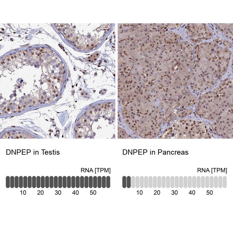 Aspartyl Aminopeptidase Antibody - BSA Free Immunohistochemistry: Aspartyl Aminopeptidase Antibody - BSA Free [NBP1-91684]