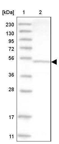 Aspartyl Aminopeptidase Antibody - BSA Free Western Blot: Aspartyl Aminopeptidase Antibody - BSA Free [NBP1-91684]