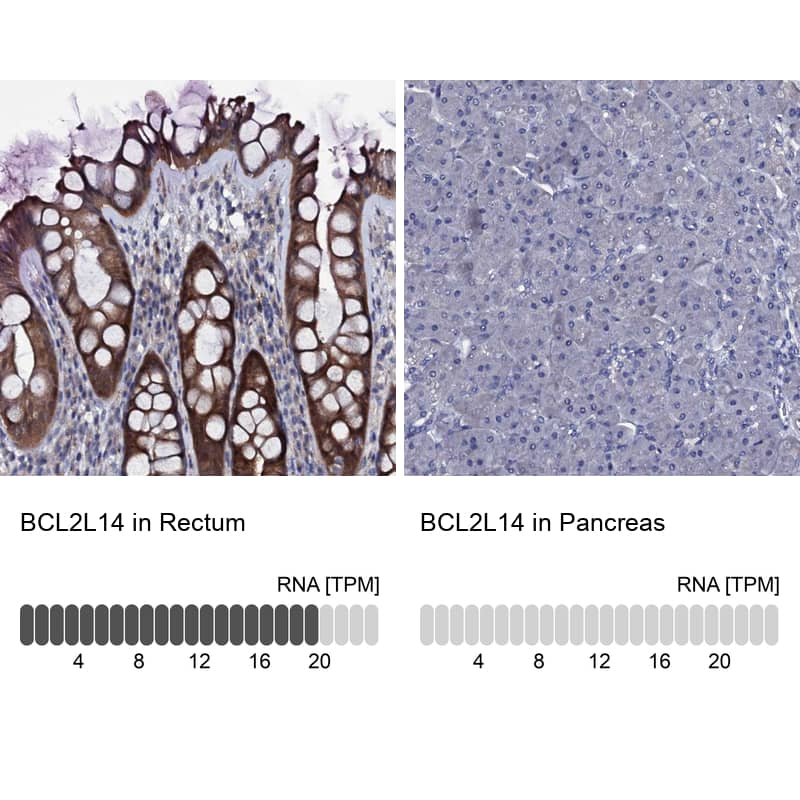 Bcl G Antibody - BSA Free Immunohistochemistry: Bcl G Antibody - BSA Free [NBP1-91697]