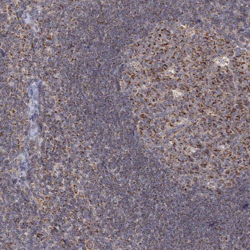 LACTB Antibody - BSA Free Immunohistochemistry: LACTB Antibody - BSA Free [NBP1-91701]