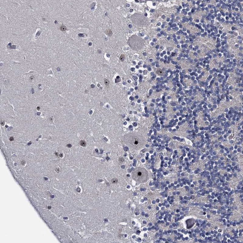 BRIX Antibody - BSA Free Immunohistochemistry: BRIX Antibody - BSA Free [NBP1-91708]