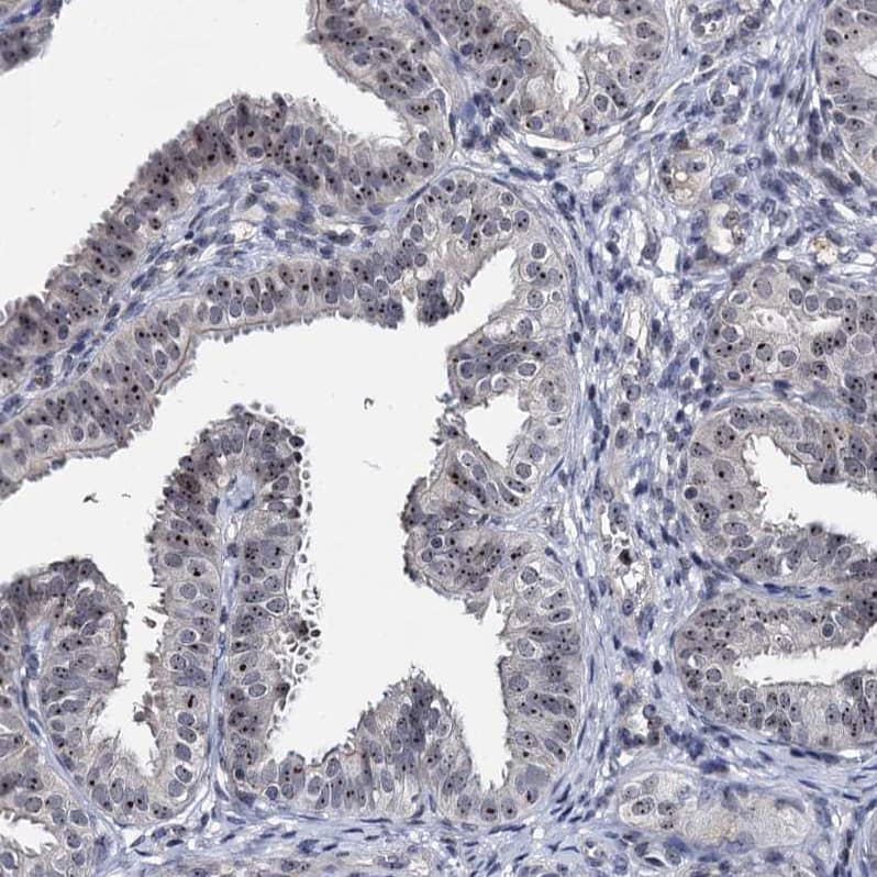 BRIX Antibody - BSA Free Immunohistochemistry: BRIX Antibody - BSA Free [NBP1-91708]