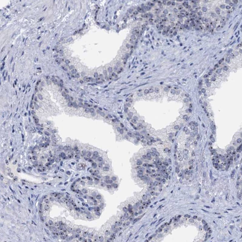 BRIX Antibody - BSA Free Immunohistochemistry: BRIX Antibody - BSA Free [NBP1-91708]