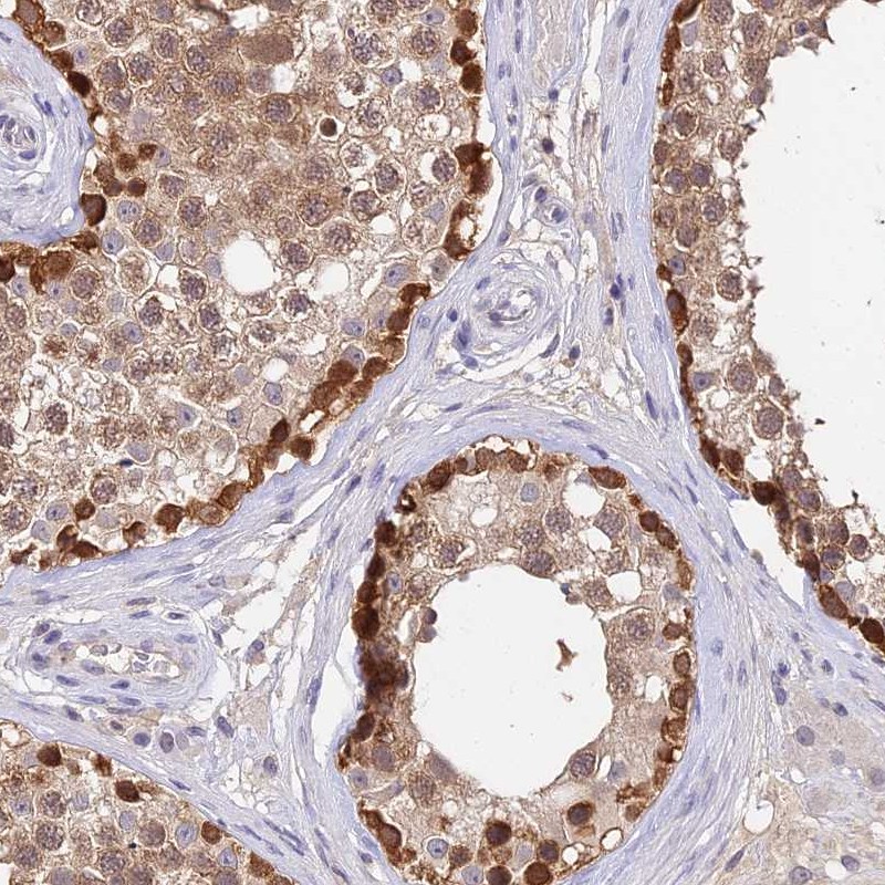 C10orf55 Antibody - BSA Free Immunohistochemistry: C10orf55 Antibody - BSA Free [NBP1-91710]