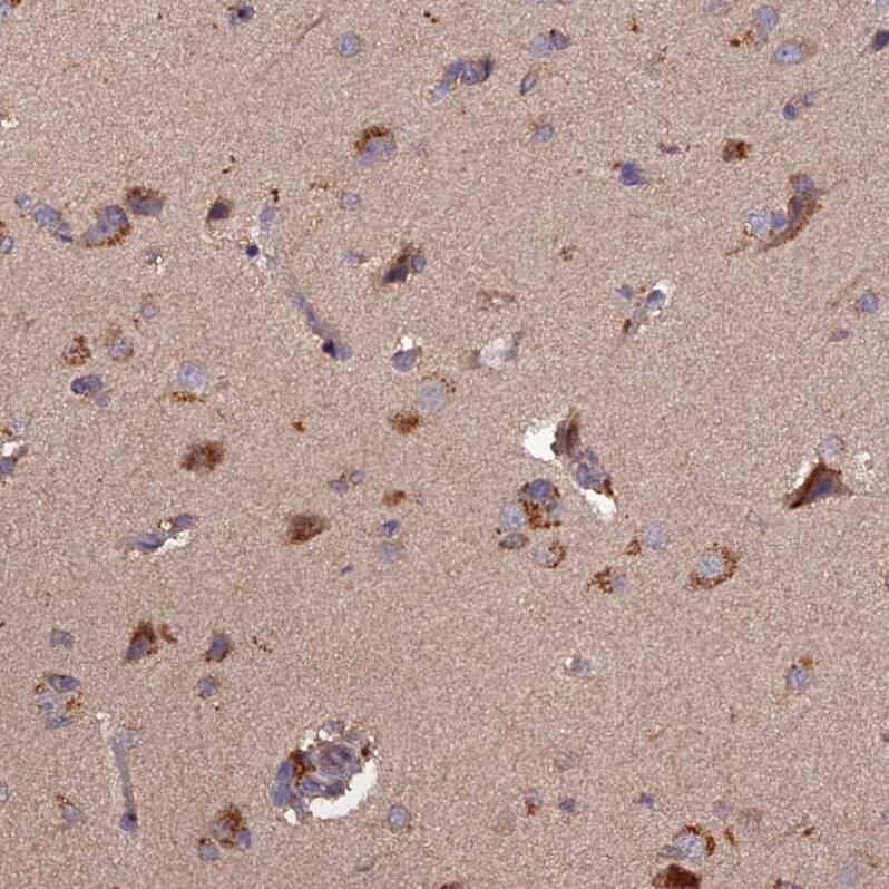 TMEM258 Antibody - BSA Free Immunohistochemistry: TMEM258 Antibody - BSA Free [NBP1-91711]