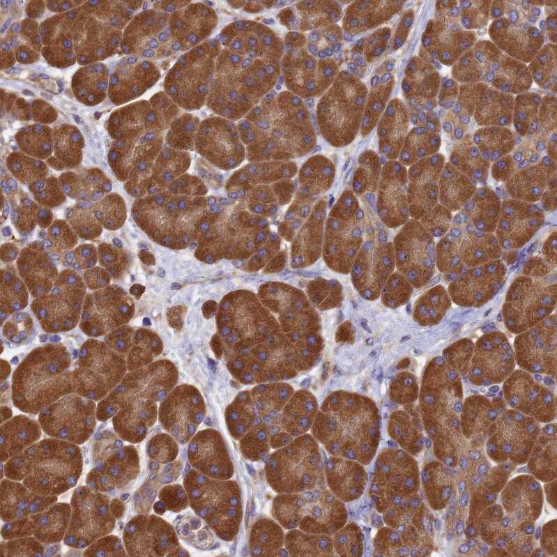 GID4 Antibody - BSA Free Immunohistochemistry: GID4 Antibody - BSA Free [NBP1-91717]