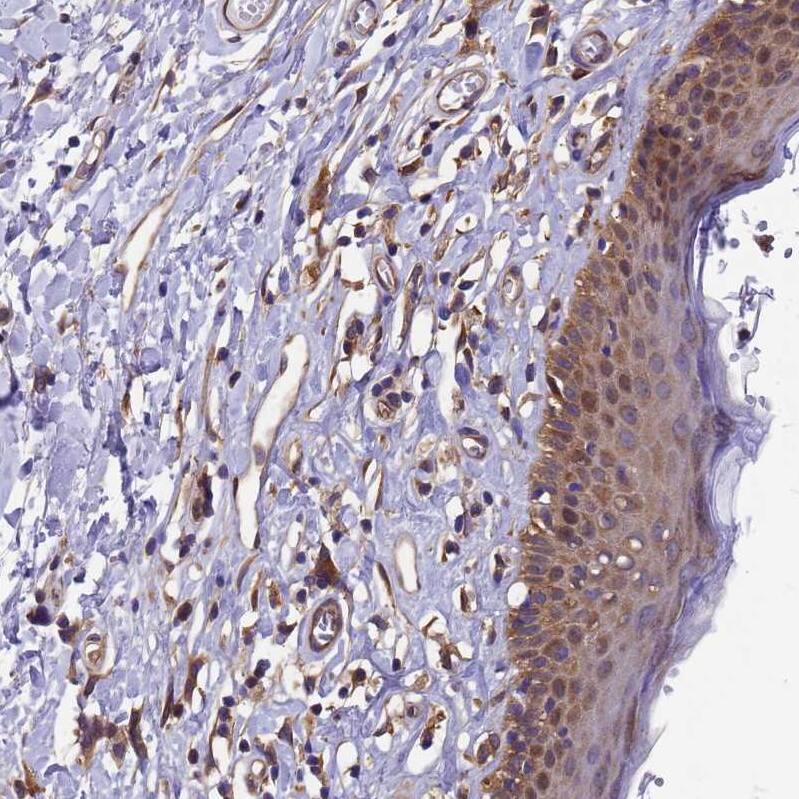 GID4 Antibody - BSA Free Immunohistochemistry: GID4 Antibody - BSA Free [NBP1-91717]