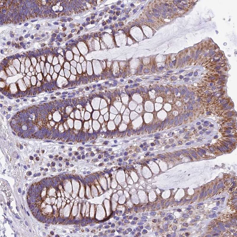 MGME1 Antibody - BSA Free Immunohistochemistry-Paraffin: MGME1 Antibody [NBP1-91726]