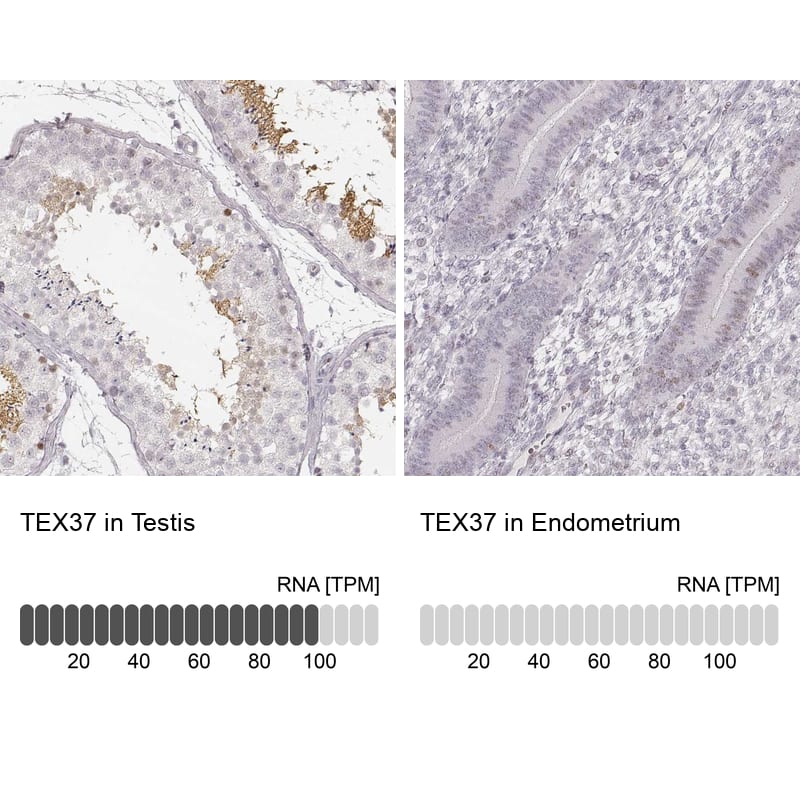 TSC21 Antibody - BSA Free Immunohistochemistry: TSC21 Antibody - BSA Free [NBP1-91727]