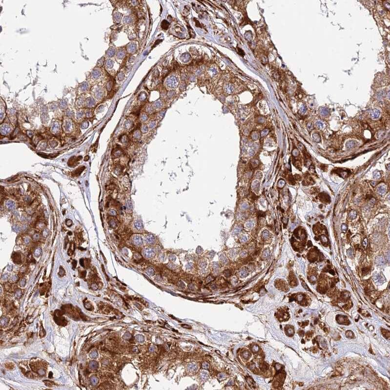 midA Antibody - BSA Free Immunohistochemistry: midA Antibody - BSA Free [NBP1-91728]