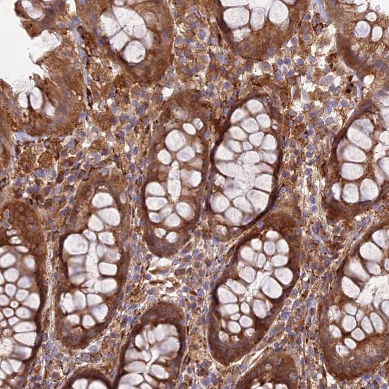 midA Antibody - BSA Free Immunohistochemistry: midA Antibody - BSA Free [NBP1-91728]