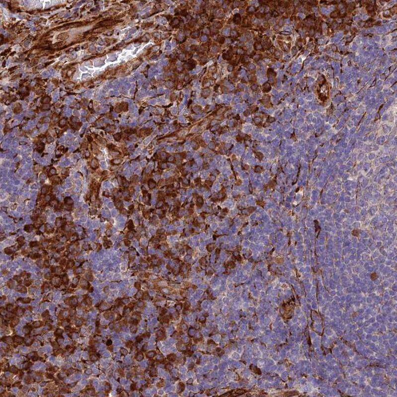 midA Antibody - BSA Free Immunohistochemistry: midA Antibody - BSA Free [NBP1-91728]