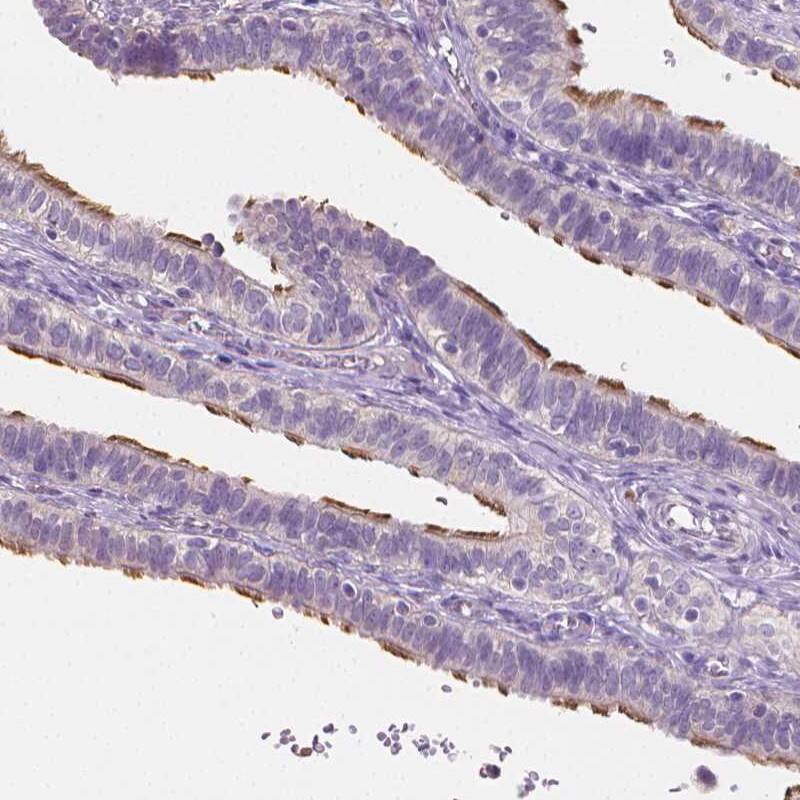 CATIP Antibody - BSA Free Immunohistochemistry: CATIP Antibody - BSA Free [NBP1-91729]