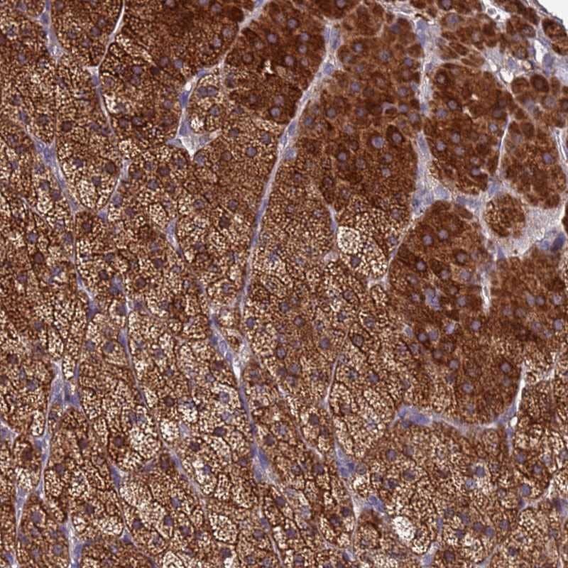 CLHC1 Antibody - BSA Free Immunohistochemistry: CLHC1 Antibody - BSA Free [NBP1-91730]