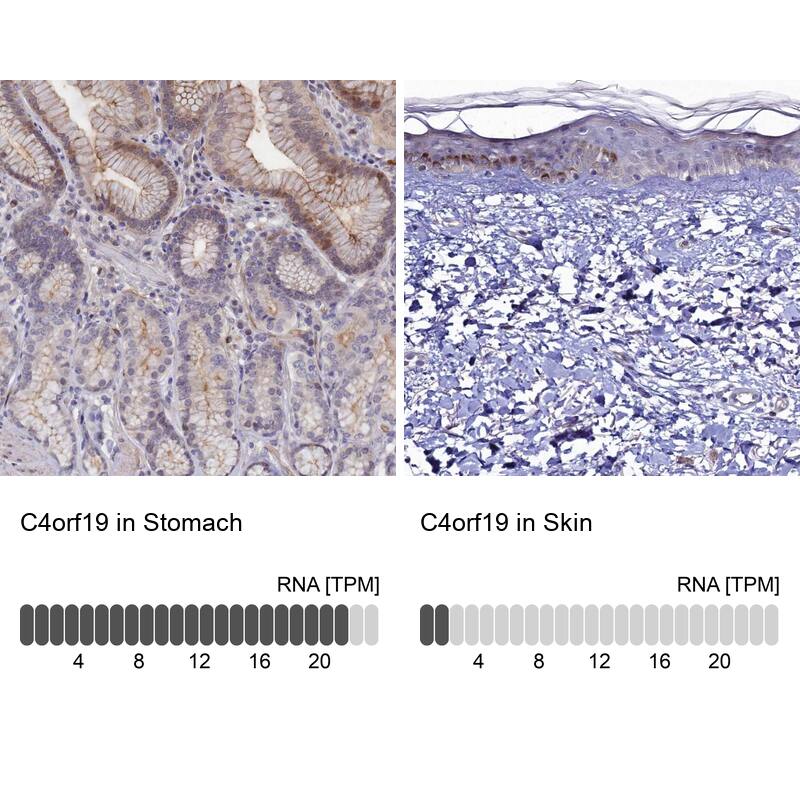 C4orf19 Antibody - BSA Free Immunohistochemistry: C4orf19 Antibody - BSA Free [NBP1-91734]