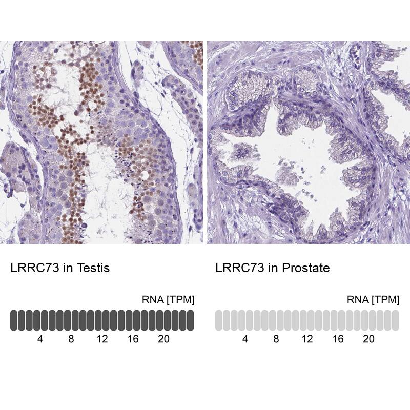LRRC73 Antibody - BSA Free Immunohistochemistry: LRRC73 Antibody - BSA Free [NBP1-91736]