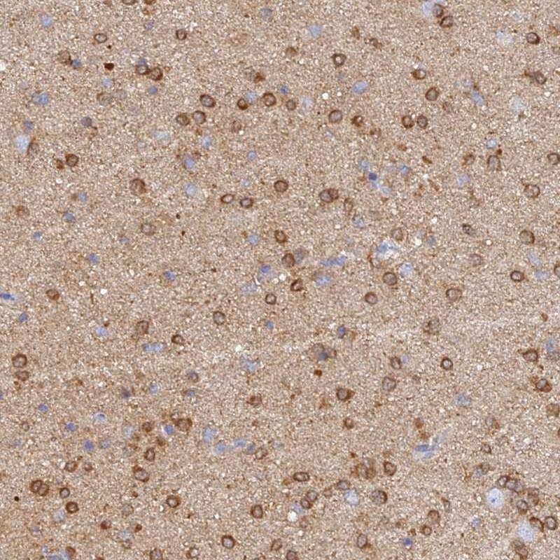 Cav2.2 Antibody - BSA Free Immunohistochemistry: Cav2.2 Antibody - BSA Free [NBP1-91744]