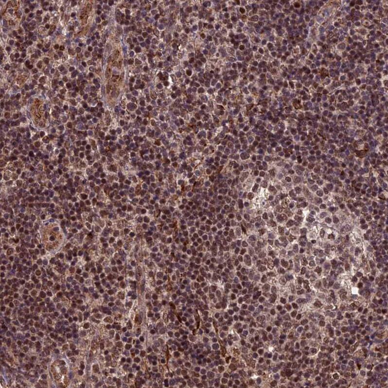 CAIN Antibody - BSA Free Immunohistochemistry: CAIN Antibody - BSA Free [NBP1-91745]