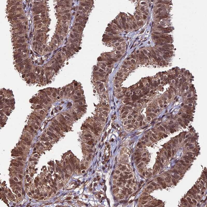 CAIN Antibody - BSA Free Immunohistochemistry: CAIN Antibody - BSA Free [NBP1-91745]
