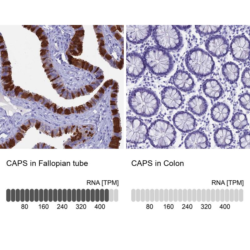 Calcyphosine Antibody - BSA Free Immunohistochemistry: Calcyphosine Antibody - BSA Free [NBP1-91746]