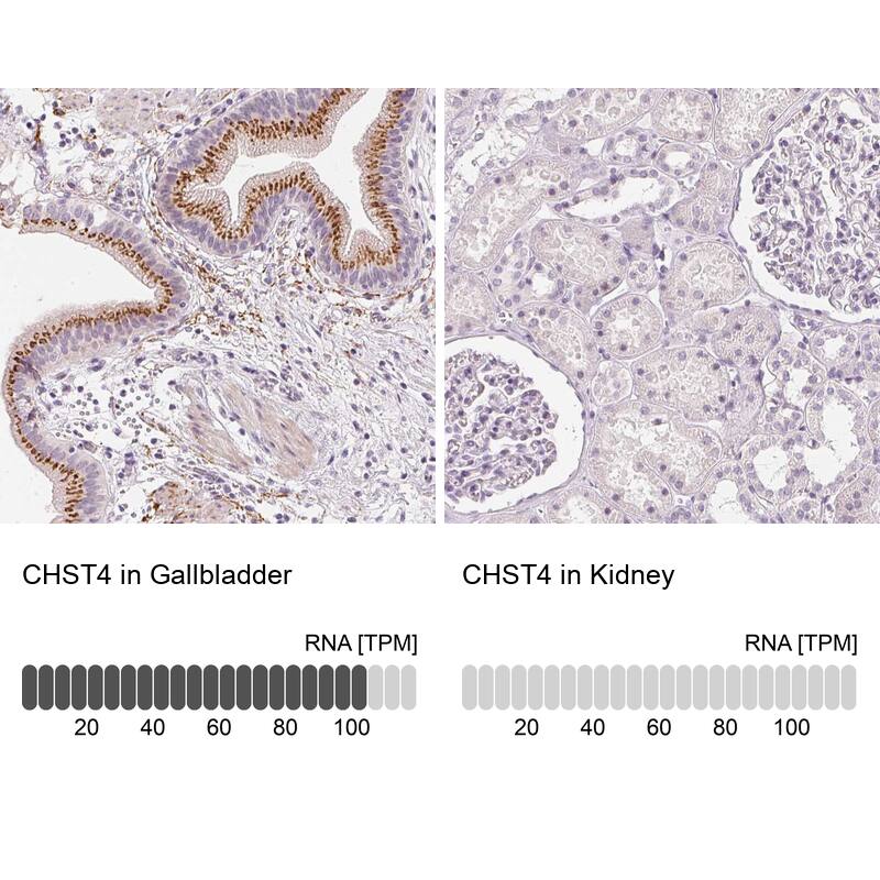 Carbohydrate Sulfotransferase 4/CHST4 Antibody - BSA Free Immunohistochemistry: Carbohydrate Sulfotransferase 4/CHST4 Antibody - BSA Free [NBP1-91748]