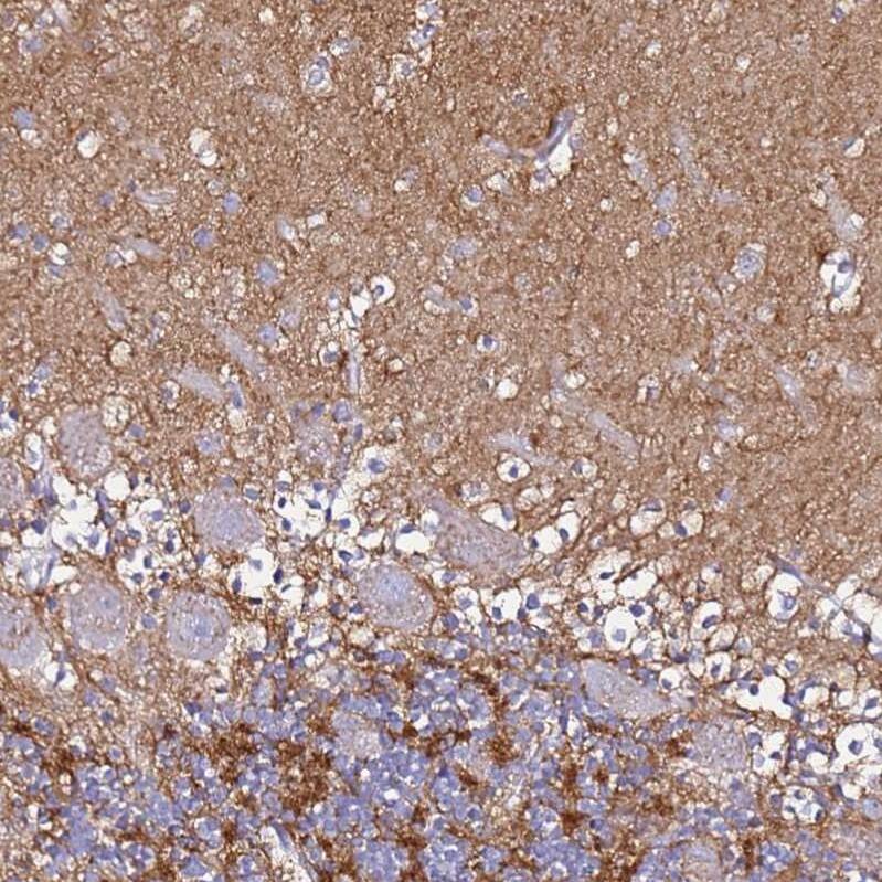 CASD1 Antibody - BSA Free Immunohistochemistry: CASD1 Antibody - BSA Free [NBP1-91750]