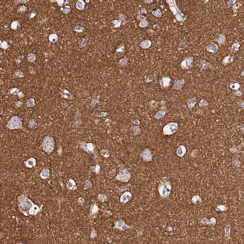 CASD1 Antibody - BSA Free Immunohistochemistry: CASD1 Antibody - BSA Free [NBP1-91750]