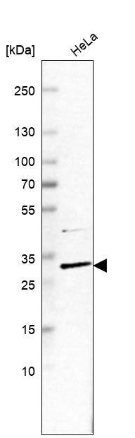 CCDC127 Antibody - BSA Free Western Blot: CCDC127 Antibody - BSA Free [NBP1-91756]