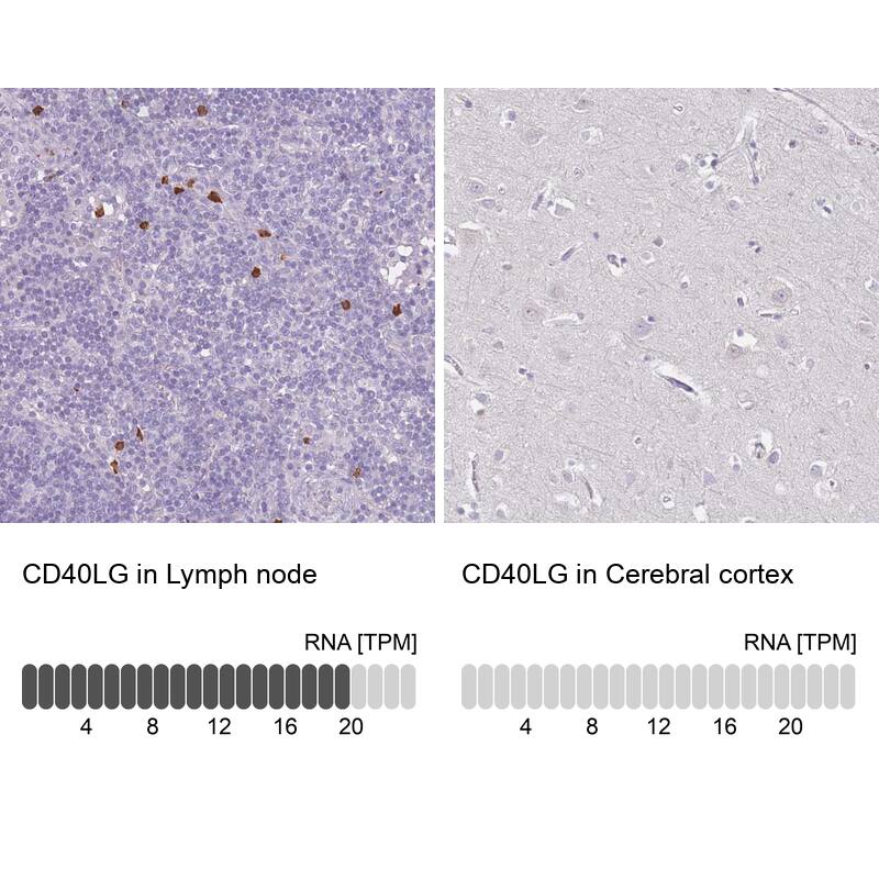 CD40 Ligand/TNFSF5 Antibody - BSA Free Immunohistochemistry: CD40 Ligand/TNFSF5 Antibody - BSA Free [NBP1-91770]