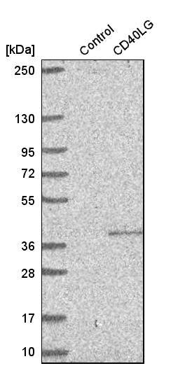 CD40 Ligand/TNFSF5 Antibody - BSA Free Western Blot: CD40 Ligand/TNFSF5 Antibody - BSA Free [NBP1-91770]