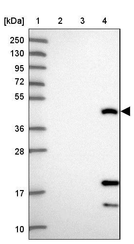 CEACAM16 Antibody - BSA Free Western Blot: CEACAM16 Antibody - BSA Free [NBP1-91777]